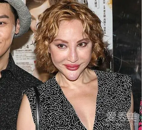 韩国女星鼻子一捏塌了!女星整容后遗症太可怕(17)