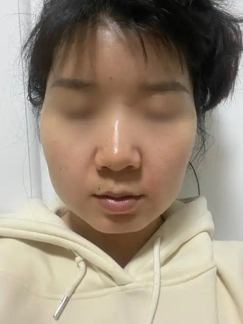 脸又大又方是咬肌大还是下颌骨大还是方脸