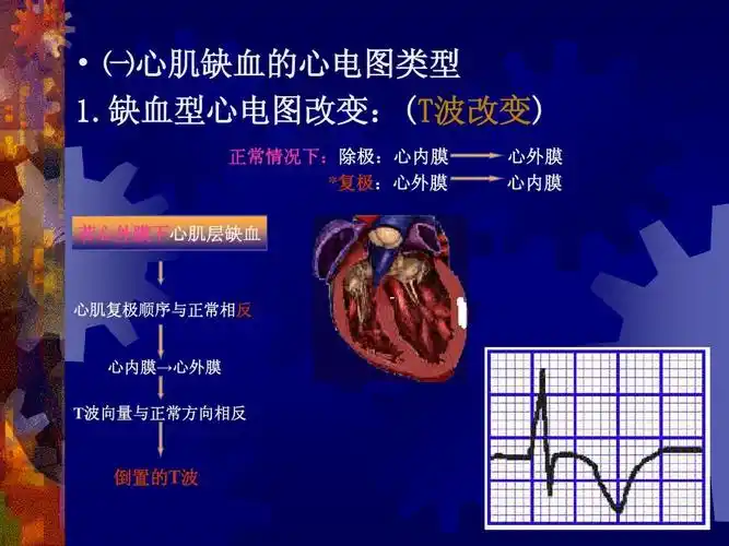 第四节心肌缺血和st-t改变ppt