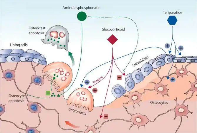 228国际罕见病日是什么疾病让孩子的骨骼像瓷器一样易碎
