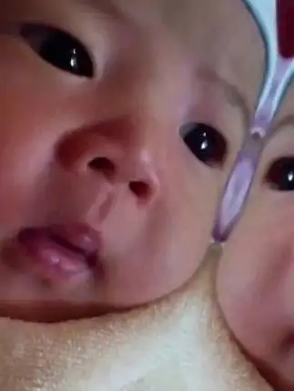 刚出生pk出生后 #相似度有几分 #从小到大的变化