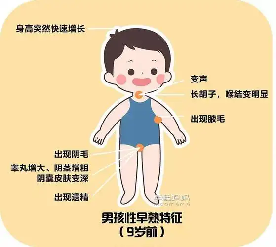 性早熟是指女孩子在8岁以前出现乳房的发育,男孩子在9岁以前出现睾丸