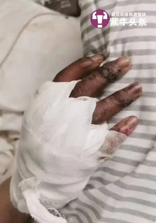 大学生夜游南京西站爬火车拍照被电击烧伤,同伴:跟着"网红打卡攻略"去