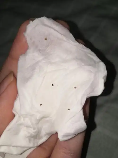 讨论请问这个是啥会是跳蚤屎吗