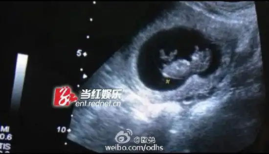 欧弟晒b超图宣布将当爹跟老天又申请了一个账号