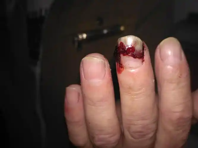 武冈市头堂乡双乐村党员兼村官打伤年老群众(图)