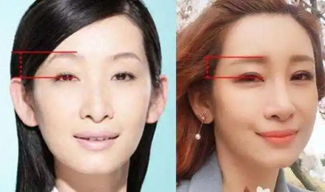 明星整容早已是公开的秘密,难就难在"见好就收"_尚雯婕_秦海璐_微调