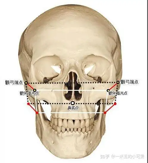 如何判断颧骨高还是颧弓宽来看看