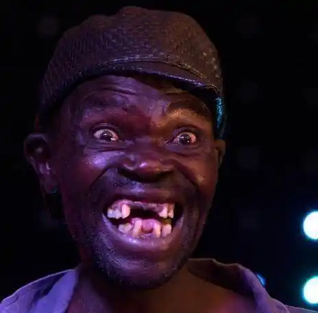 他用了7年变成世界最丑的人无人能敌