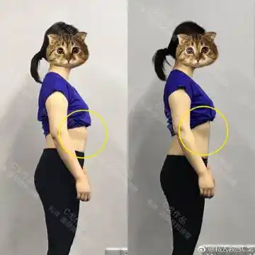 后期改良版本将会推出各位自我肋骨外翻矫正可先参照视频教程网页链接