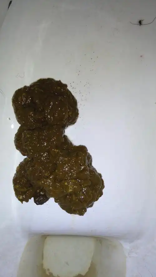 儿子拉成这种颜色的粑粑算怎么会事?