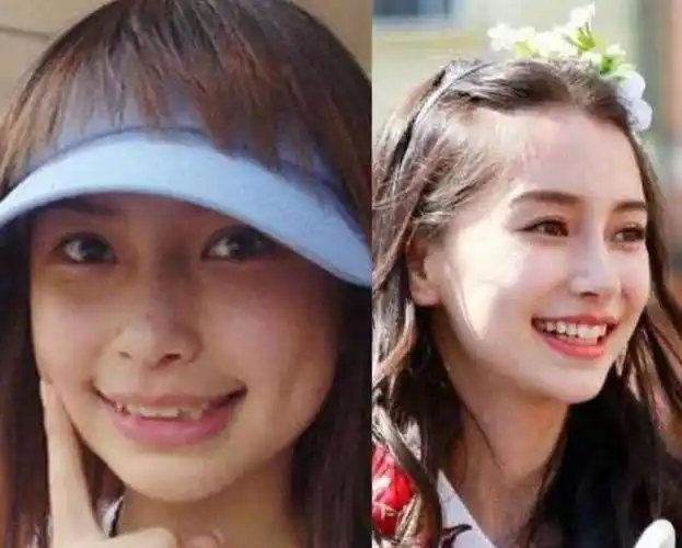 半个娱乐圈的明星都靠它悄悄变成瓜子脸!不是整容