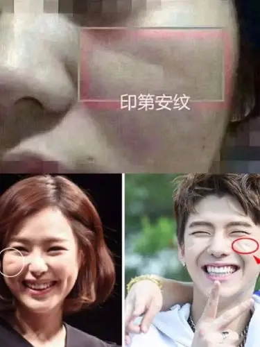 整容失败其实是印第安纹