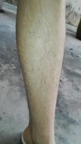 女生腿毛旺盛是怎样的人生体验?