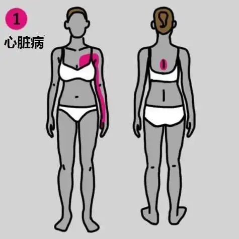 有心脏问题或是心脏病的人通常会出现左手臂与胸口疼痛,建议出现这些