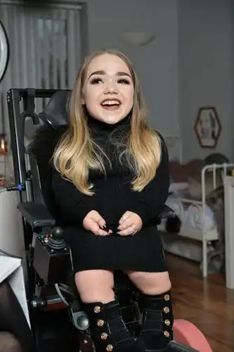 19岁少女患侏儒症,身高只有80cm,成为英国最矮的女人!