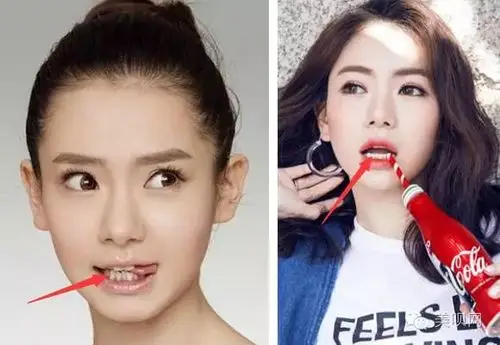 丸子头戴美瞳画风越来越网红的戚薇生了孩子后到底经历了什么