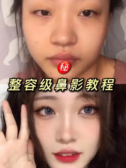 整容级鼻影教程92蒜头鼻886