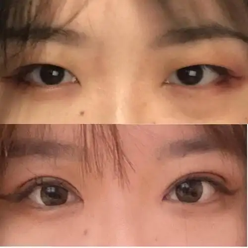 姐妹们我是不是开眼角开了个寂寞