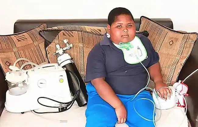 11岁巨胖因肥胖并发症去世饿起来连卫生纸都吃