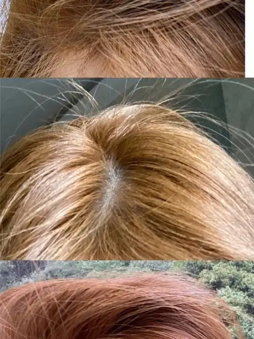 染发失败爆顶还能补救吗