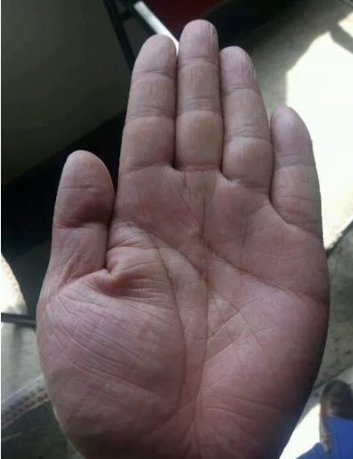 手相:那个神乎其神的"通天纹",竟然长这样!