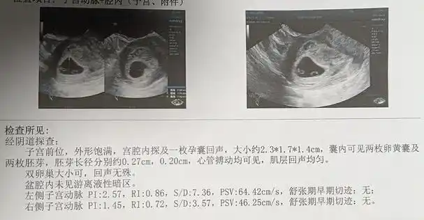 "当时我的心一下子吊了起来,想到了一些不好的想法.
