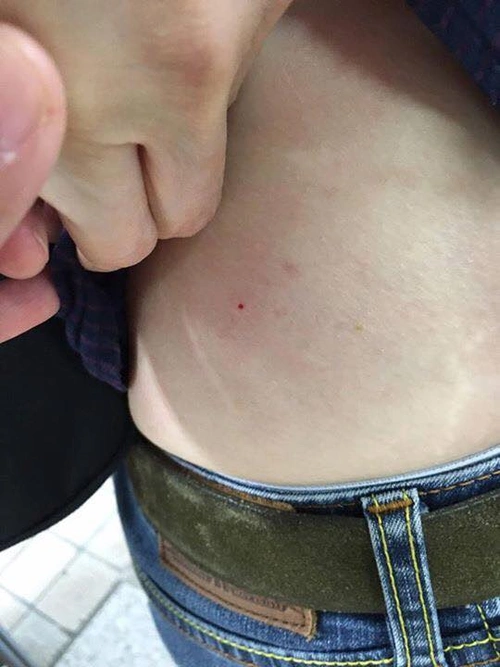 惊悚!韩国老妇街头将注射器刺入外国游客身体