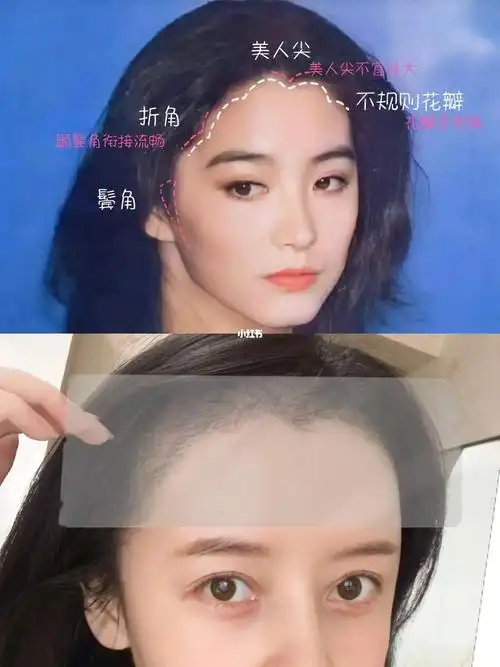 做发际线还是要看港风模板