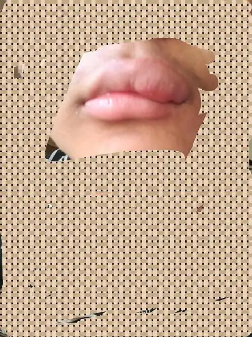 我的嘴唇早上醒来就肿了,也不知道为什么,因为,什么会肿,怎么可以消肿