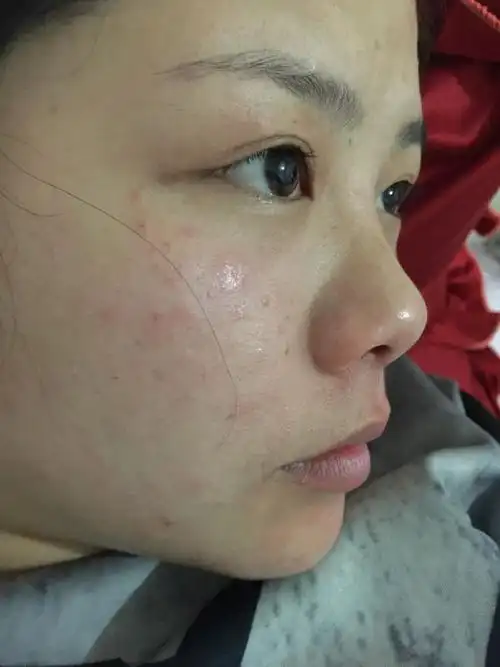 手和脸都特别痒起一些小疙瘩,想知道这到底是啥啊