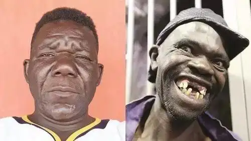 他是世界最丑男人获得四届选丑冠军被人抗议不准参赛了