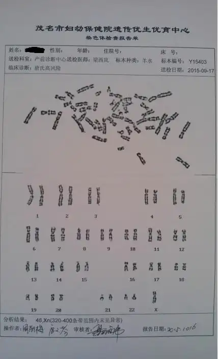 怎么从染色体检查报告看小孩子性别?