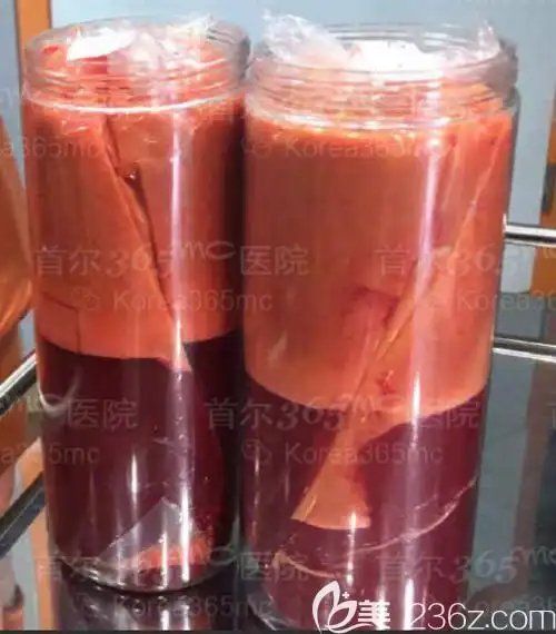 365mc医院抽取出的脂肪