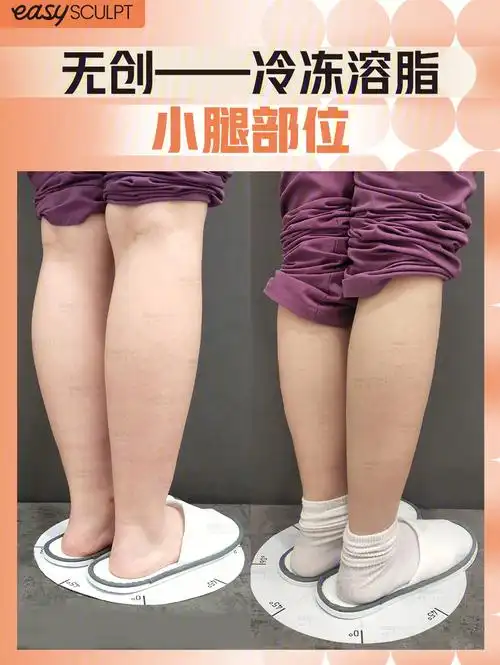 生活中,有很多女生身材还不错,但是小腿特别粗壮肥大,尝试了很多方式