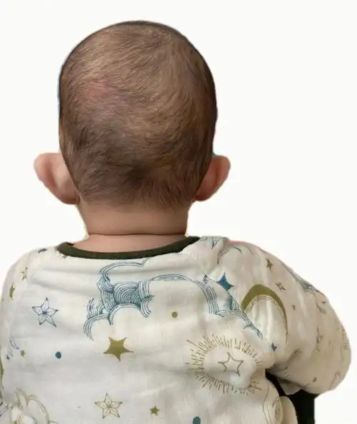 居易请老师麻烦看看宝宝头型5个半月,头顶尖,两边有犄角,后脑勺也有