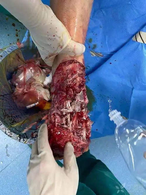 邀请讨论     1楼 全部讨论(3) dc1983 发布于 2020-02-09 10:44 清创