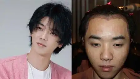 华晨宇整容还植发?早年旧照视频曝光,相貌与现在判若两人