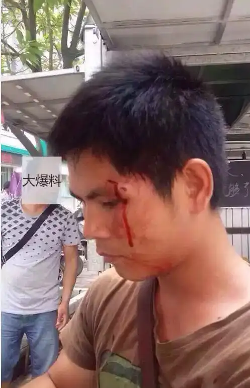 5月4日上午城管暴力执法,在吉田大厦附近打伤人,求公道