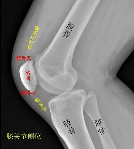 小髌骨腻害了竟能整出这么多事影像日记005期