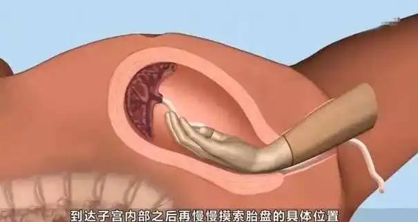 产道|生完孩子,女人产道究竟能撑多大?这个演示很生动,张张伟大