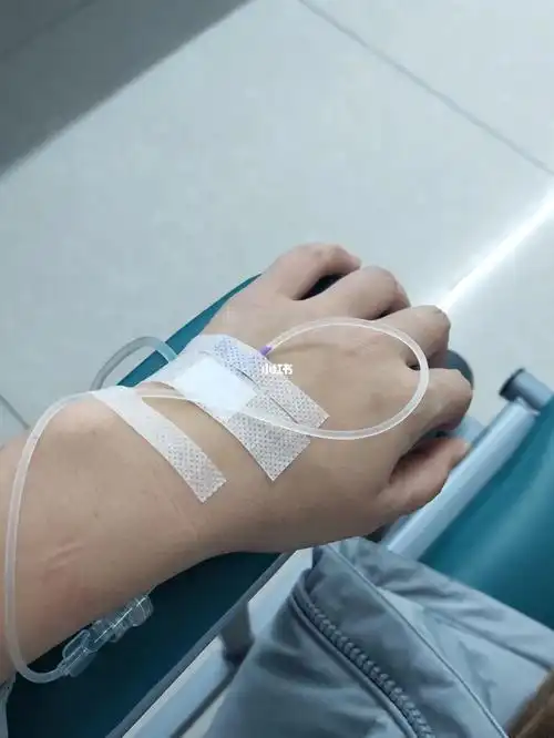 七天十三针,两只手都打肿了.