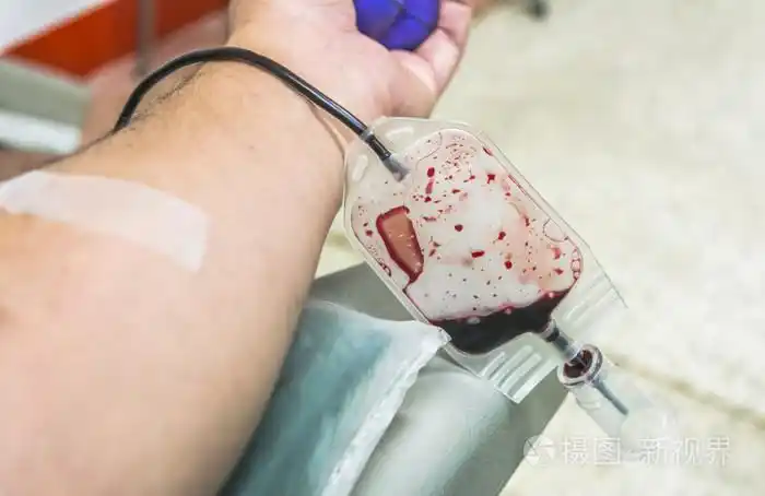 输血的特写无偿献血活动上白孤立的献血,护士刺穿血献血者手臂静脉针