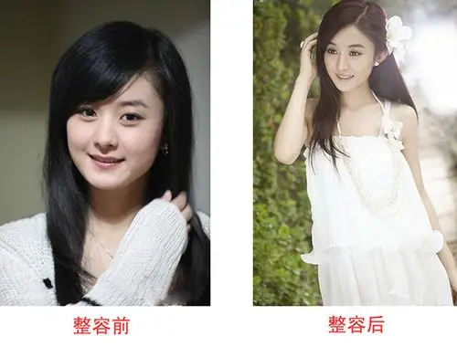 图赵丽颖整容前后照片被骂滚出娱乐圈的五大原因大揭秘