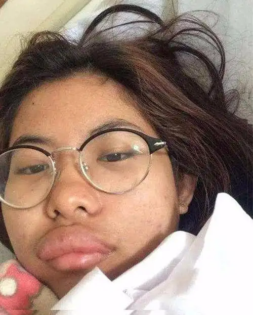 自拍照片不仅引网友哈哈大笑,也因此收获了粉丝大家评论直说好丑好丑