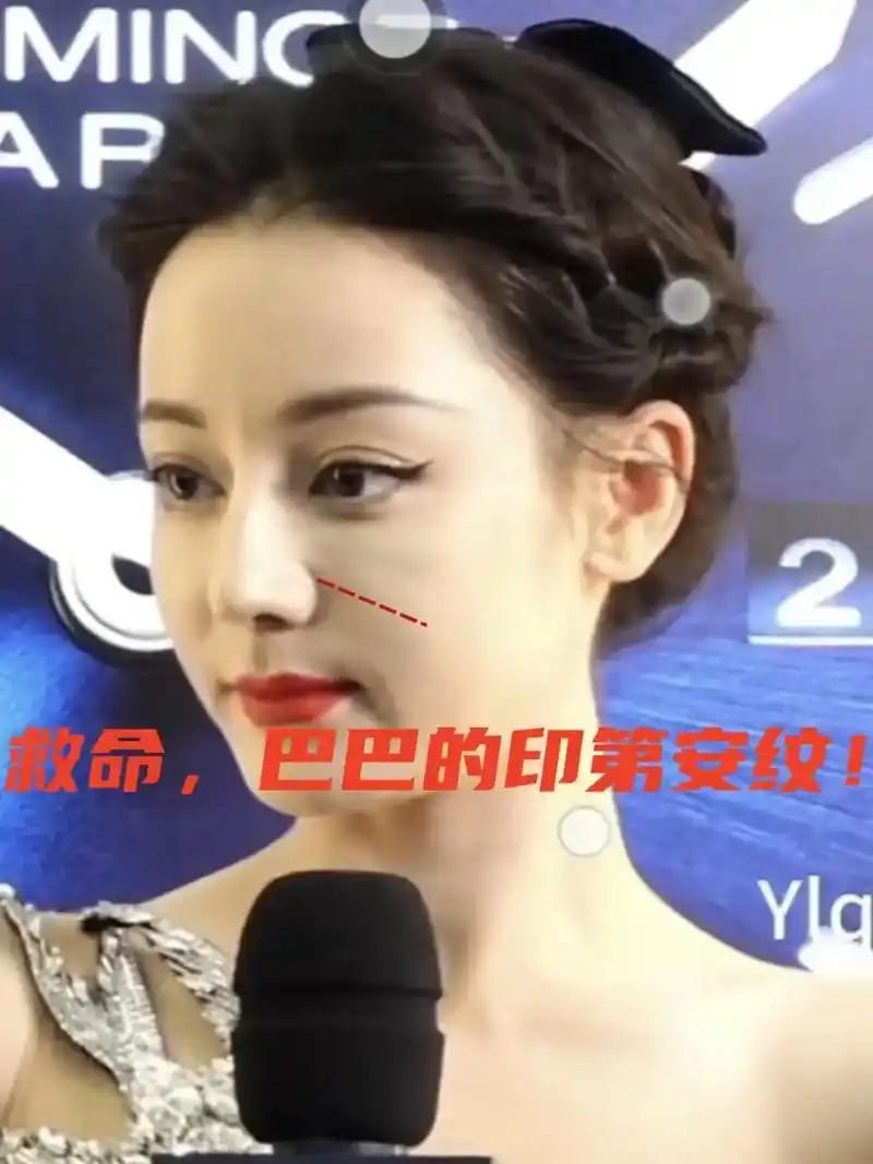 救命,迪丽热巴印第安纹怎么这么严重了?