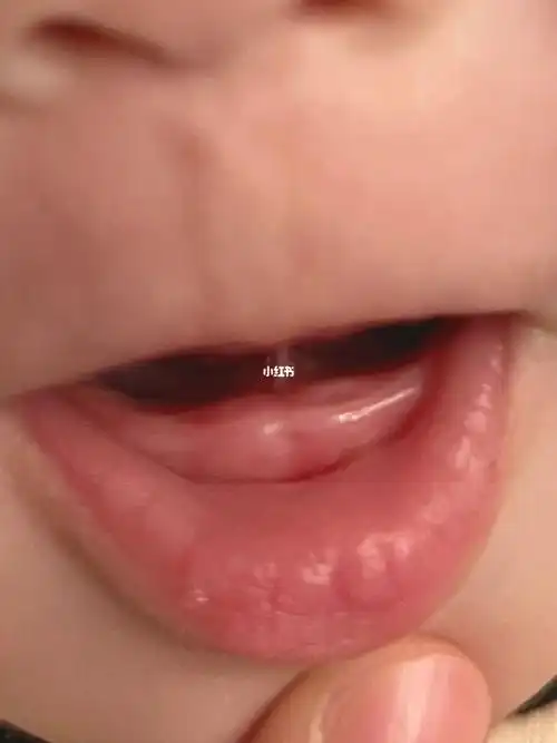 宝宝  #宝宝长牙  #宝宝喝奶