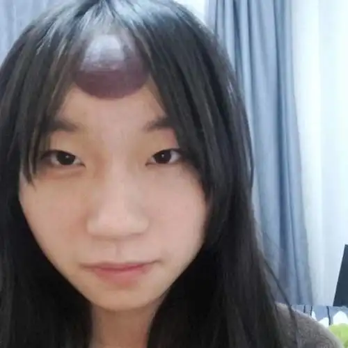 额头驱风 中医警告:拔错部位可致中风 | 新生活报 - ilifepost爱生活