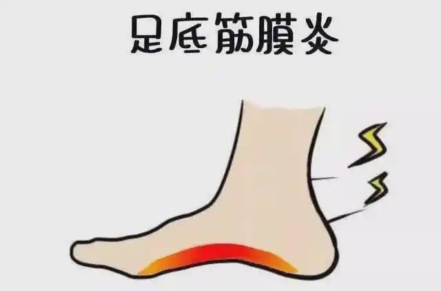 巨伤脚的鞋子排行榜人字拖上榜第4个你一定穿过