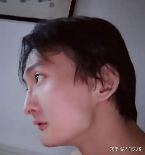 正脸正常,侧脸丑到爆是什么体验? - 知乎